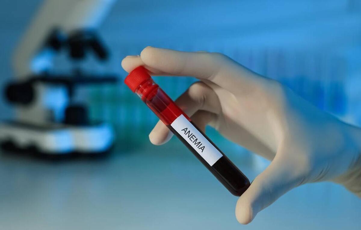 什么维生素补铁(维生素补铁效果最好的)-硒宝网