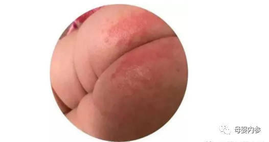 感冒期间可以补锌吗(感冒期间补锌可以补多久)-硒宝网