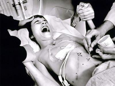 喝富硒茶治疗乙肝吗(喝茶乙肝治疗富硒好吗)-硒宝网