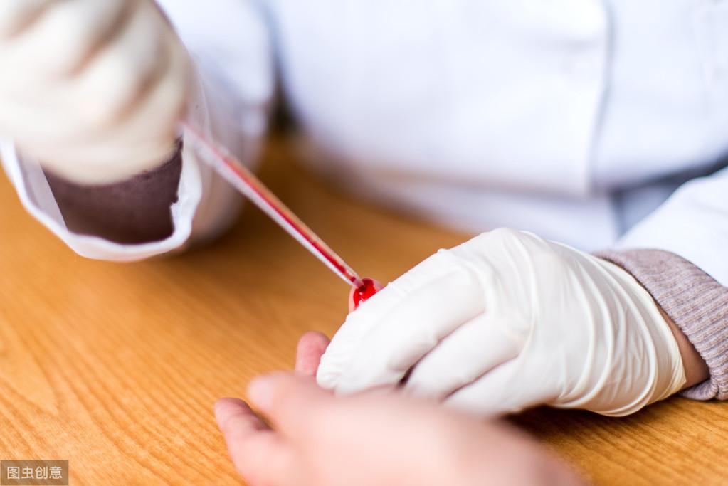 微量元素检查有必要吗（必要微量元素检查有几项）-硒宝网