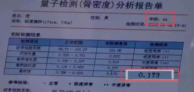 60岁以上老人补钙吃什么钙片好(老年人补钙吃钙片好吗)-硒宝网