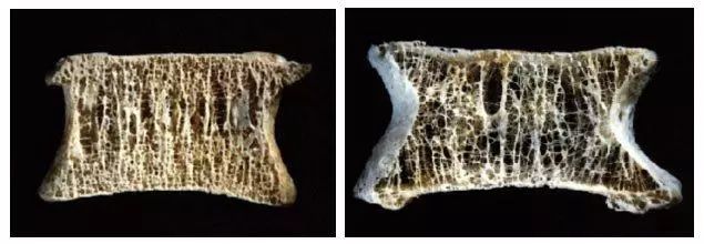 骨质增生需要补钙吗(补钙骨质增生)-硒宝网