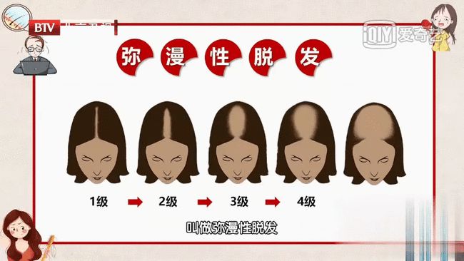 掉头发缺什么微量元素（缺微量掉头发元素有哪些）-硒宝网