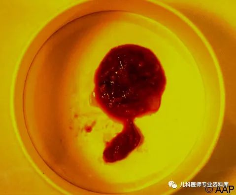 小孩子补锌吃哪个牌子的比较好（补锌给孩子补锌买什么牌子的好）-硒宝网