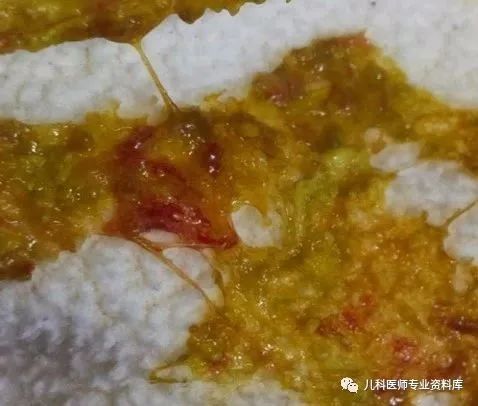 小孩子补锌吃哪个牌子的比较好（补锌给孩子补锌买什么牌子的好）-硒宝网