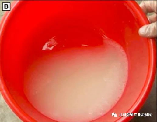 小孩子补锌吃哪个牌子的比较好（补锌给孩子补锌买什么牌子的好）-硒宝网