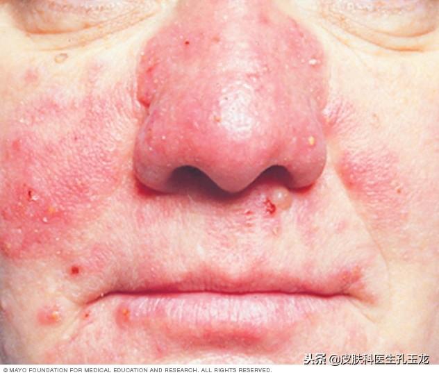 怎样补锌(补锌有什么作用和功效)-硒宝网