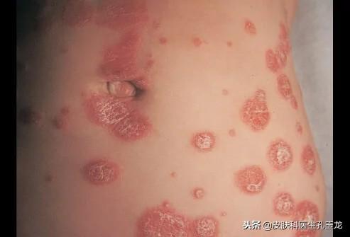 怎样补锌(补锌有什么作用和功效)-硒宝网