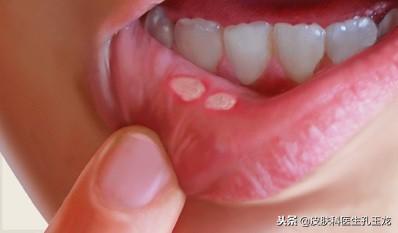 怎样补锌(补锌有什么作用和功效)-硒宝网