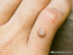 怎样补锌(补锌有什么作用和功效)-硒宝网