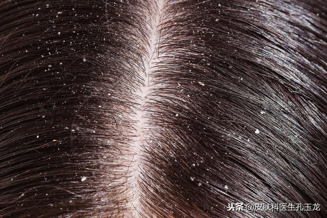 怎样补锌(补锌有什么作用和功效)-硒宝网