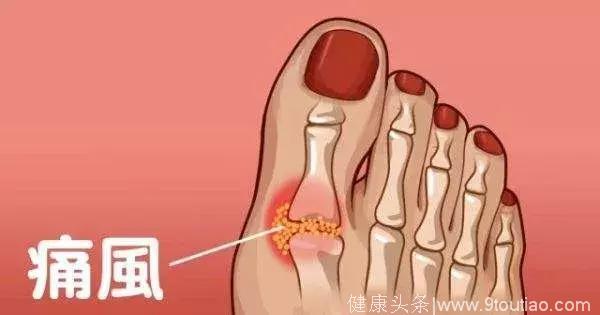 血钠低怎么补(低钠血症的补钠公式)-硒宝网