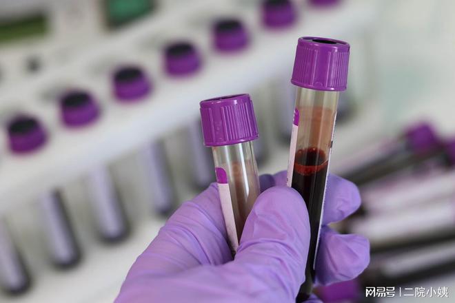 孕中期补钙吃什么钙片比较好（孕中期补钙要吃多久）-硒宝网