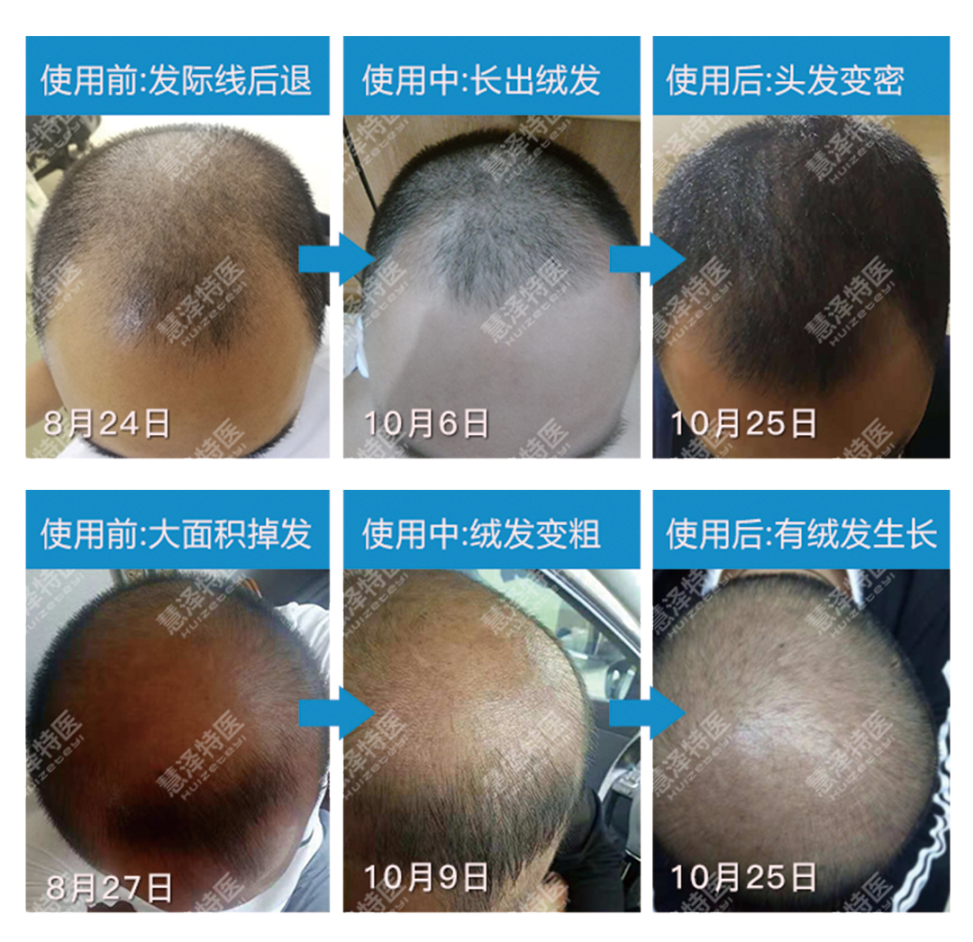 吃什么可以补充微量元素(微量元素可以食补吗)-硒宝网