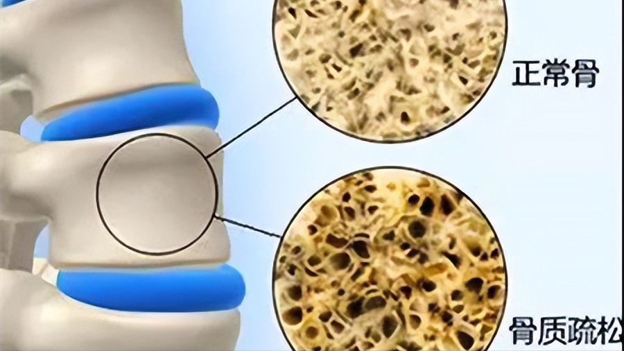 补钙的针剂有副作用吗（补钙针副作用症状如何）-硒宝网