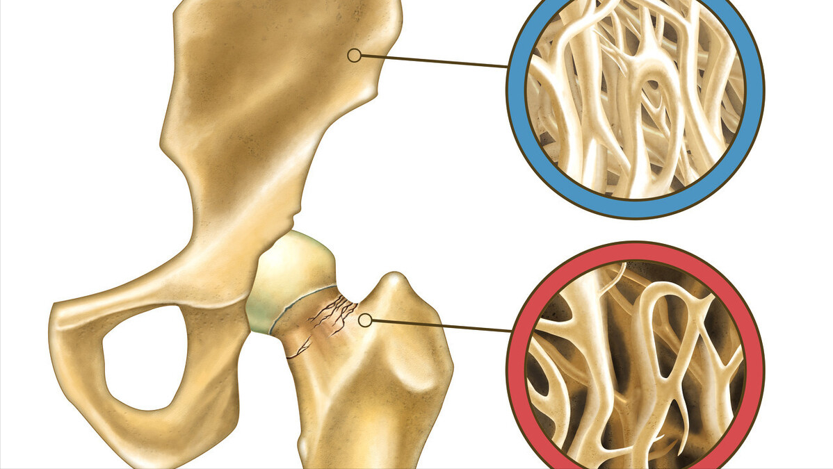 补钙的针剂有副作用吗（补钙针副作用症状如何）-硒宝网