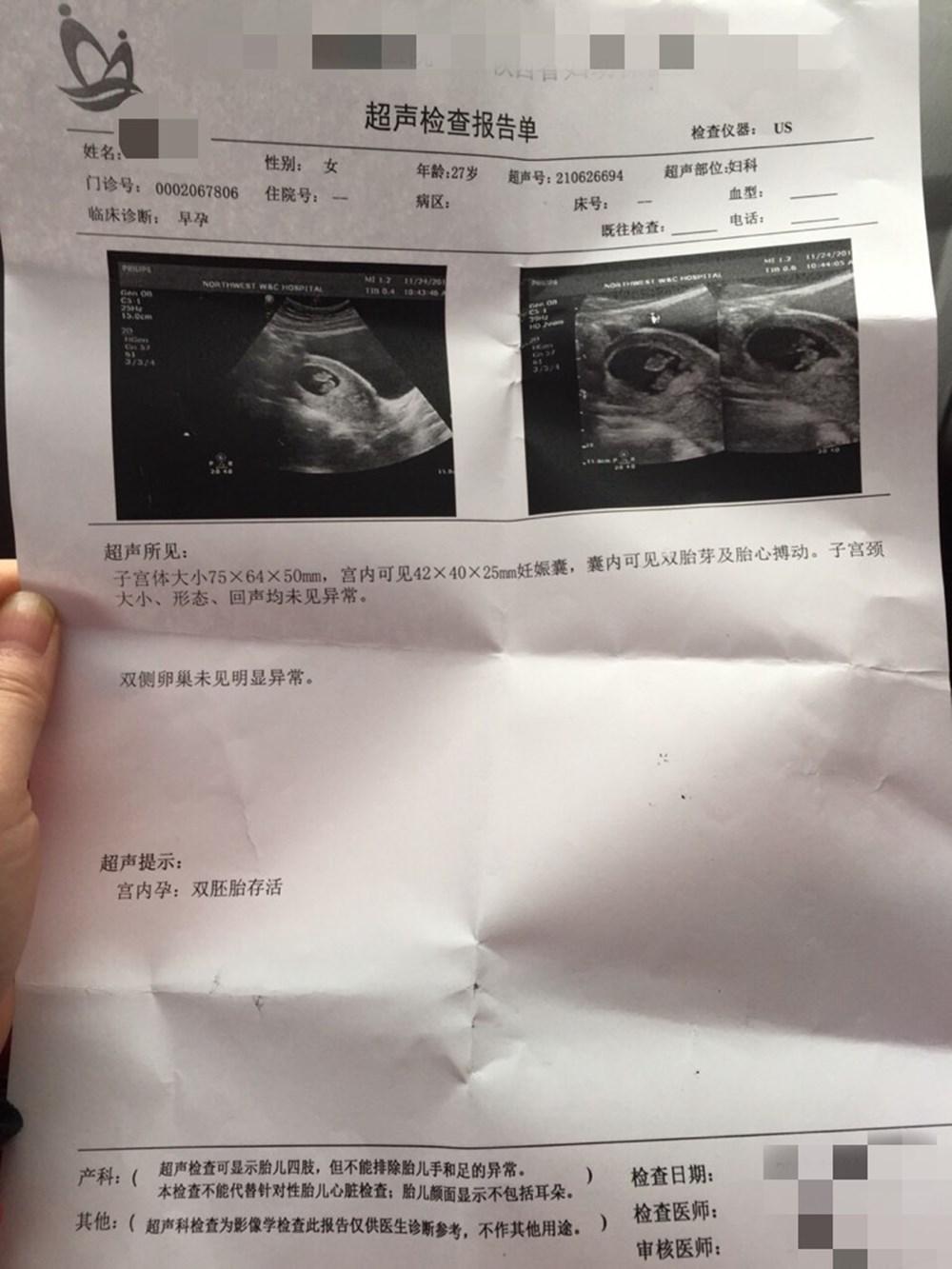 小孩子查微量元素需要空腹吗（空腹查微量元素孩子需要小便吗）-硒宝网