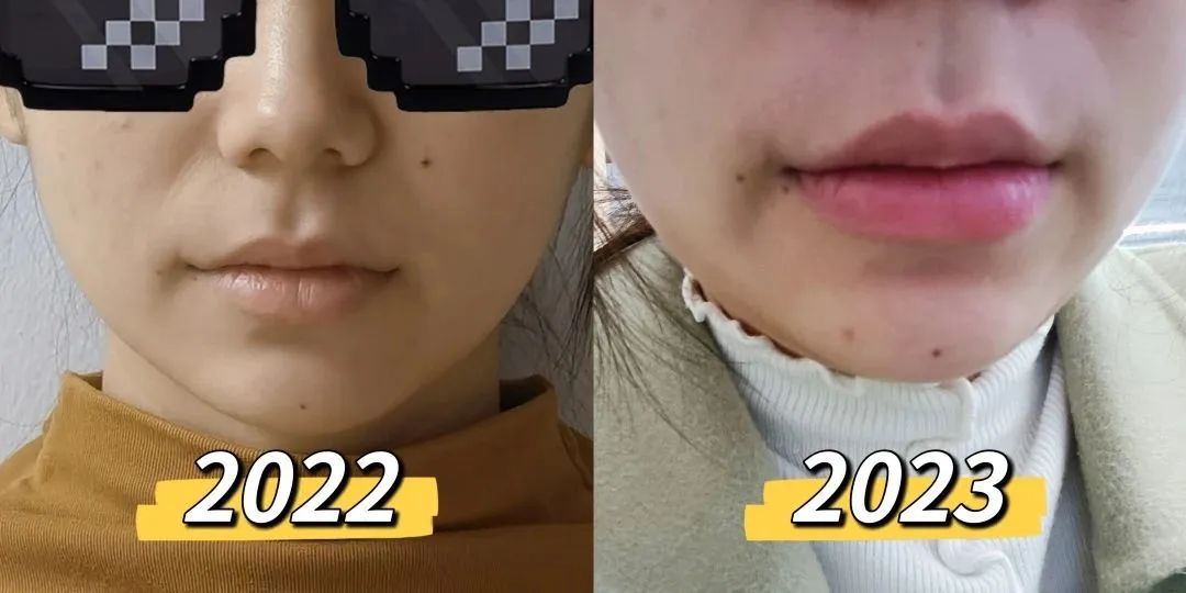 牛肉能补铁吗（牛肉能补铁和血吗）-硒宝网