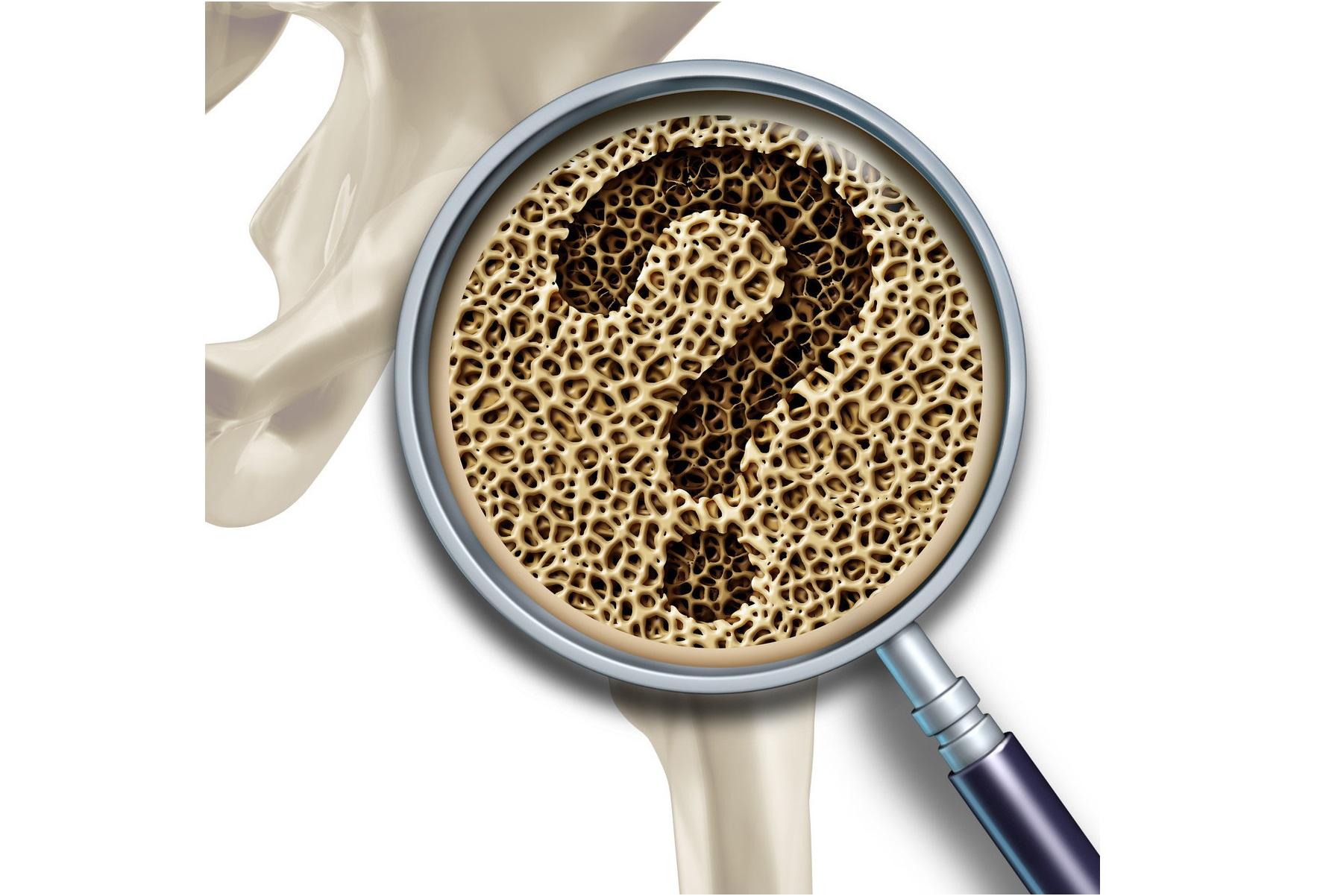 补钙的针（针剂补钙的利与弊）-硒宝网