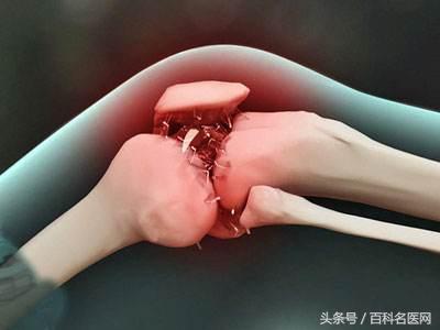 补钙吗（补钙最好的食品是什么）-硒宝网