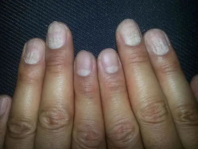 什么水果富硒多糖多(富硒对水果的作用如何)-硒宝网