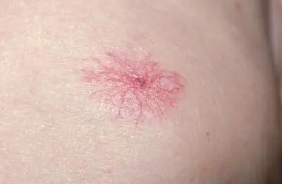 什么水果富硒多糖多(富硒对水果的作用如何)-硒宝网