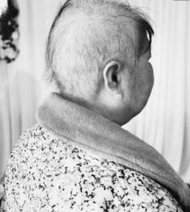 儿童化疗后补硒产品(化疗后补充硒)-硒宝网