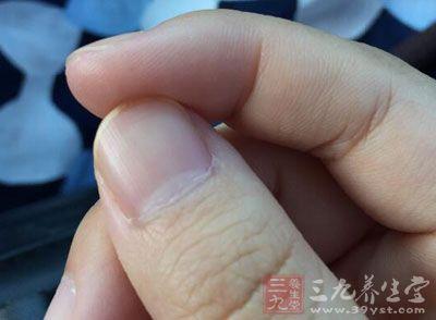 缺锌白斑补锌会消失吗(消失白斑缺锌补锌会好吗)-硒宝网