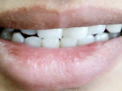 男人需要补钙吗(补钙男人需要吃多久)-硒宝网