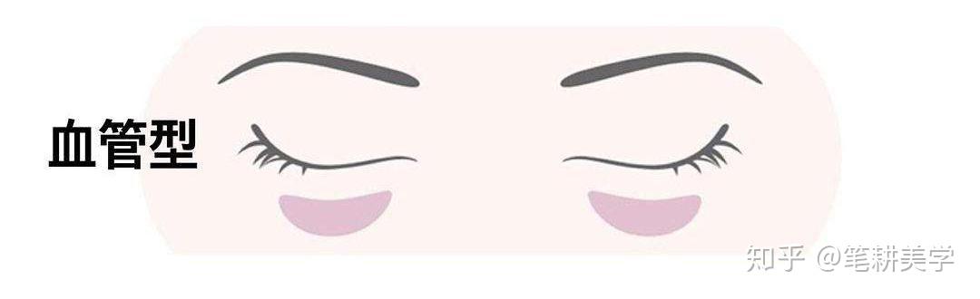 第六代硒产品是什么(硒类产品)-硒宝网