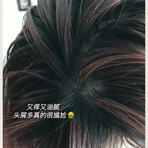 硒维康和硒酵母区别(硒维康与酵母硒哪个好)-硒宝网