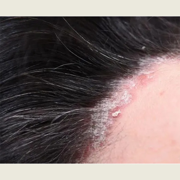 硒维康和硒酵母区别(硒维康与酵母硒哪个好)-硒宝网