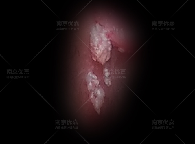 硒维康哪种牌子最好（硒维康哪个牌子治hpv好）-硒宝网