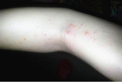 磨牙缺什么微量元素(缺微量元素磨牙会出血吗)-硒宝网