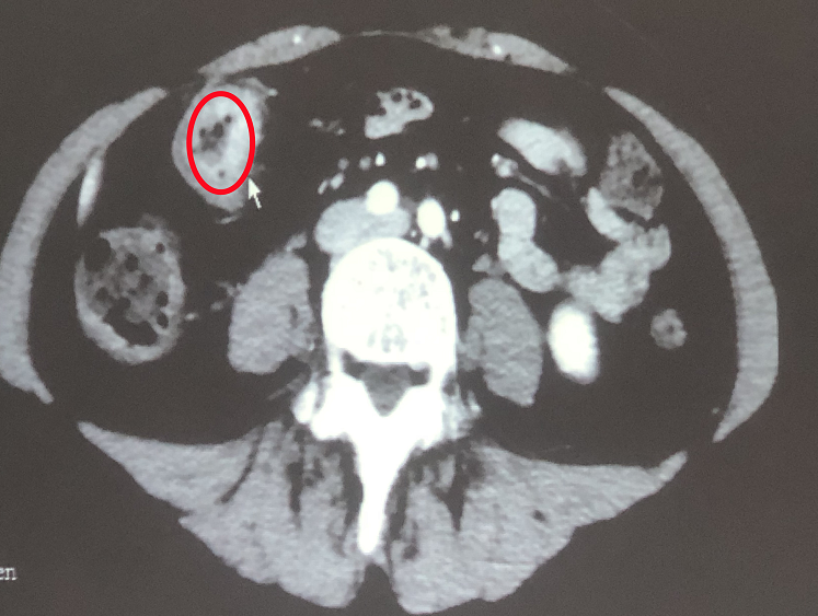 硒维康一盒含多少硒(硒维康是保健品吗)-硒宝网
