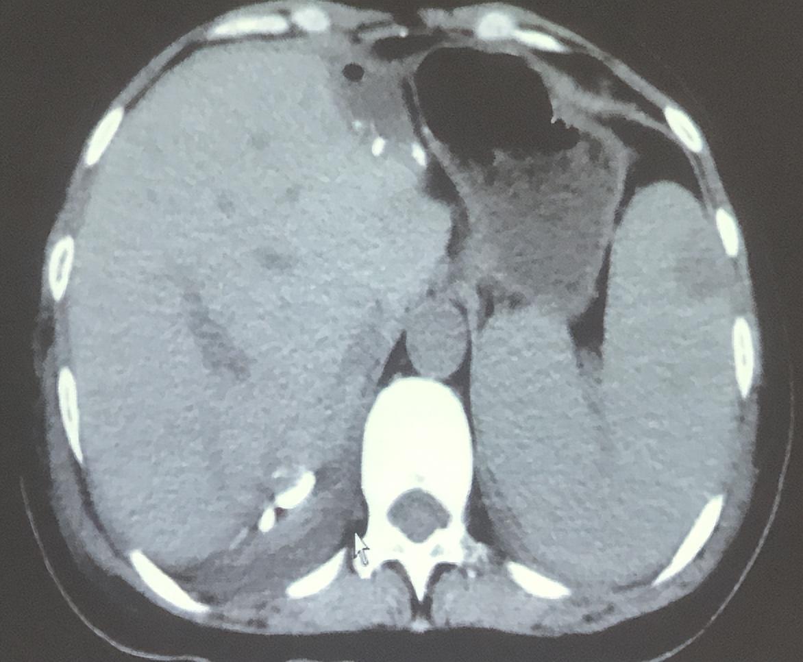 硒维康一盒含多少硒(硒维康是保健品吗)-硒宝网