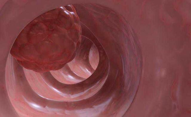 硒维康可以治肝病吗(硒维康可以长期服用吗)-硒宝网