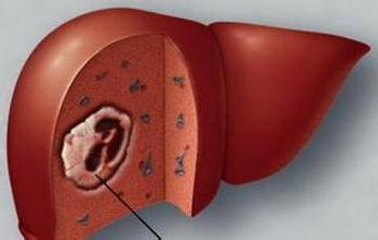 乙肝患者服用硒维康(服用患者乙肝硒维康片会怎样)-硒宝网