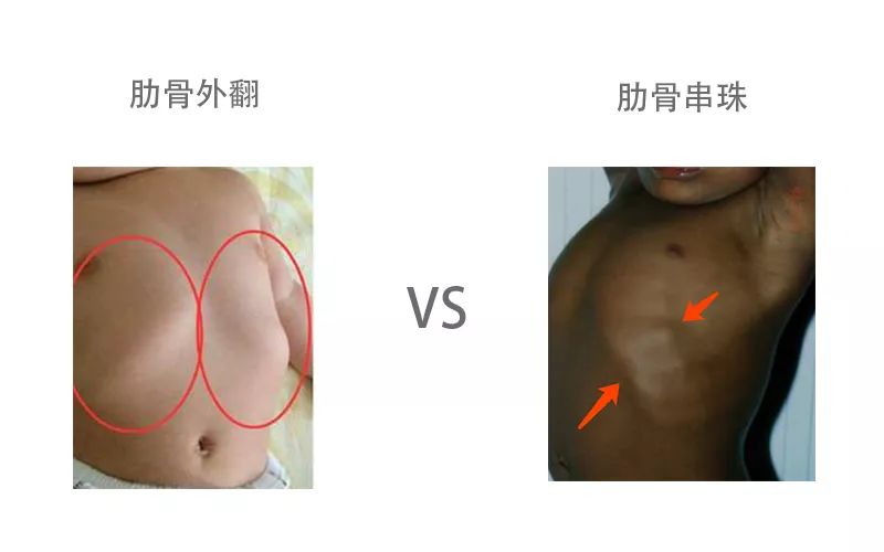 婴儿补铁剂哪个品牌好（婴儿补铁剂哪个牌子好）-硒宝网