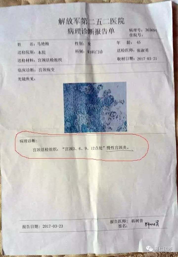 直肠癌能吃硒维康吗(肠癌病人可以吃硒酵母吗)-硒宝网