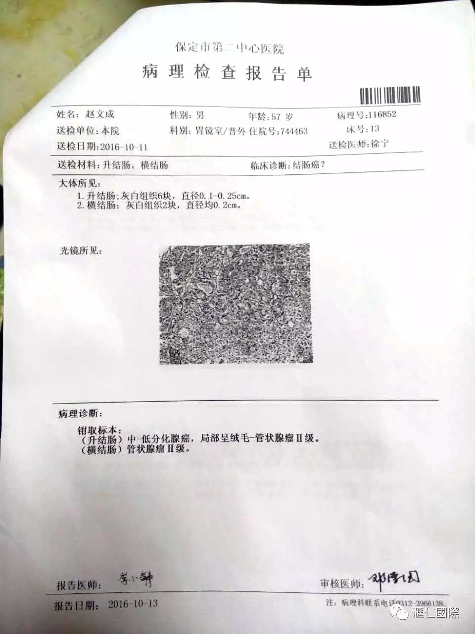 直肠癌能吃硒维康吗(肠癌病人可以吃硒酵母吗)-硒宝网