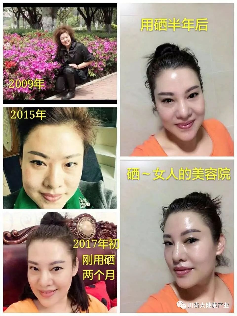 直肠癌能吃硒维康吗(肠癌病人可以吃硒酵母吗)-硒宝网