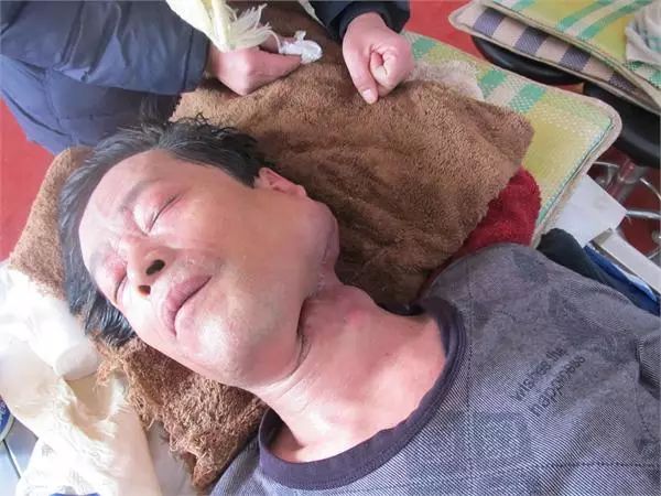 直肠癌能吃硒维康吗(硒对肠癌有作用吗)-硒宝网