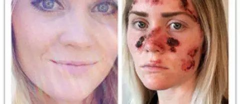 直肠癌能吃硒维康吗(硒对肠癌有作用吗)-硒宝网