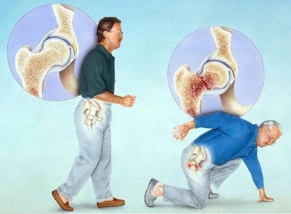 老年人如何补钙效果好（老好人补钙什么好）-硒宝网