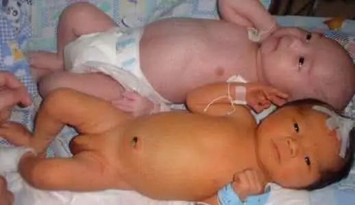 新生儿多久开始补钙(新生儿开始补钙好吗)-硒宝网