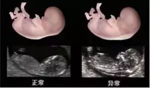 查微量元素需要空腹抽血吗（微量元素化验空腹吗）-硒宝网