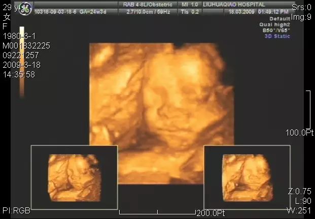 查微量元素需要空腹抽血吗（微量元素化验空腹吗）-硒宝网