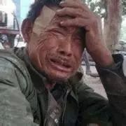 微量元素20项要多少钱（微量元素需要检查什么）-硒宝网