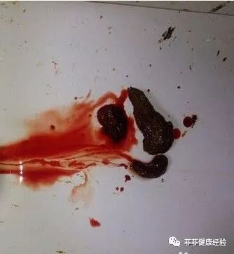 硒维康片能治胃病吗（硒维康刺激胃吗）-硒宝网